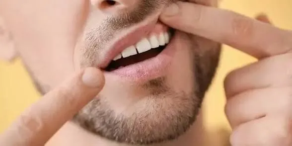 لا تتجاهل نزيف اللثة.. قد يدل على نقص فيتامين حيوي